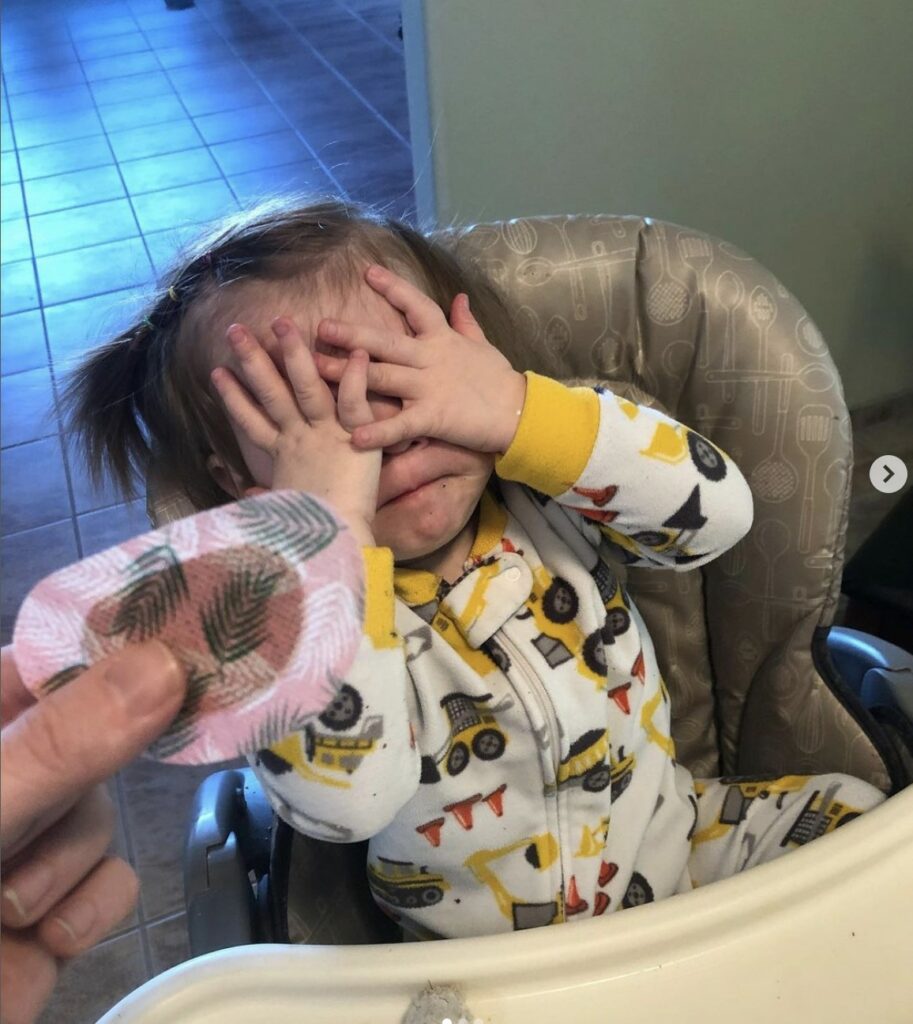 Sutton Sea at 15 months old sitting in a high chair covering her eyes, with her mom’s hand reaching towards her with an eye patch indicating Sutton did not want to wear her eyepatch.